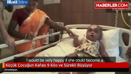 Küçük Çocuğun Kafası 9 Kilo ve Sürekli Büyüyor