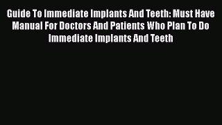 Read Guide To Immediate Implants And Teeth: Must Have Manual For Doctors And Patients Who Plan