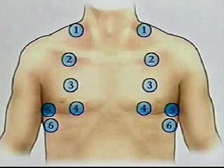 Chest Examination 10   Auscultation of the Anterior Thorax