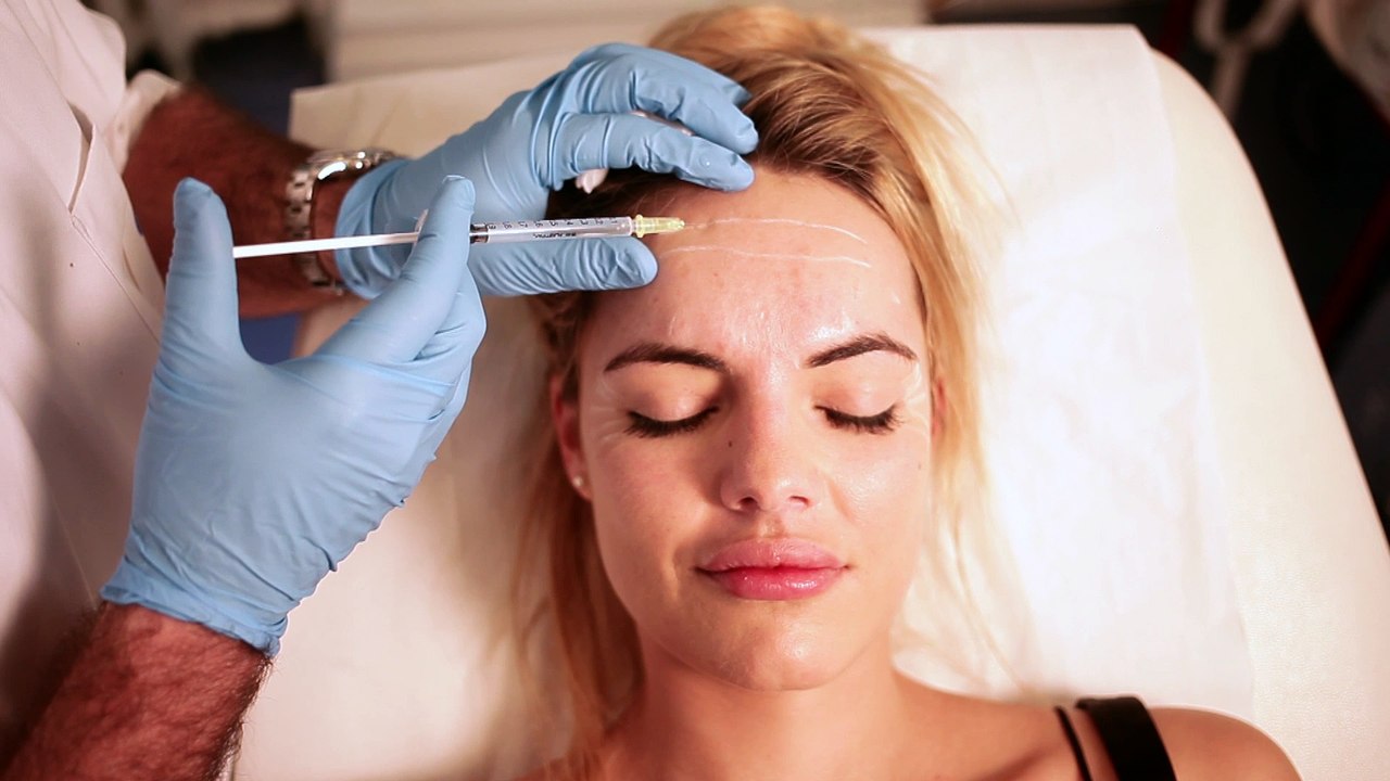 Toxine botulique, traite les rides d'expression et la transpiration