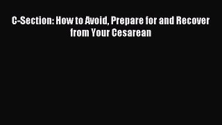 [Download] C-Section: How to Avoid Prepare for and Recover from Your Cesarean  Full EBook