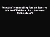 Read Acne: Acne Treatments! Stop Acne and Have Clear Skin Now (Skin Ailments Detox Alternative