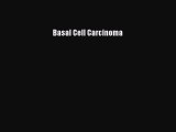 Download Basal Cell Carcinoma PDF Free