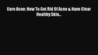 Download Cure Acne: How To Get Rid Of Acne & Have Clear Healthy Skin... Ebook Online