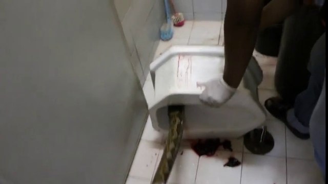 Il se fait mordre pénis par un python alors qu'il est assis sur les toilettes