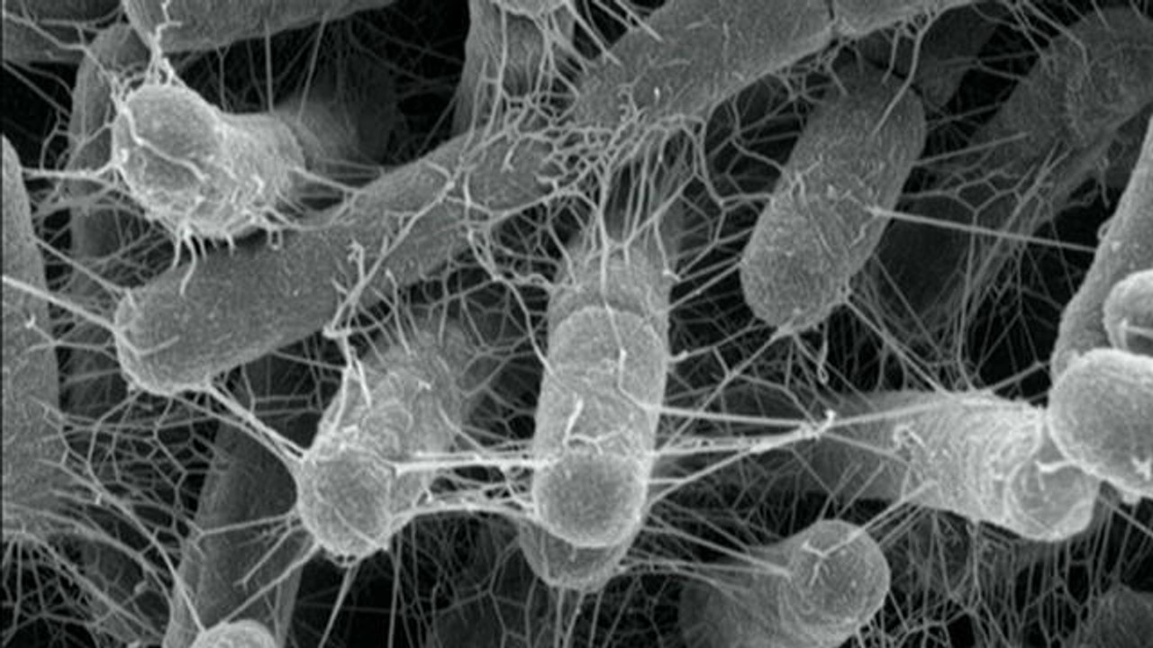 Une "super-bactérie" résistante à tous les antibiotiques? - Le 27/05/2016 à 18h45