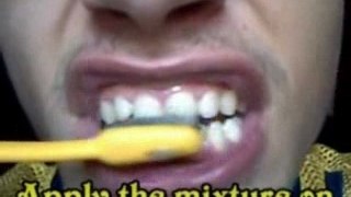 How to make your teeth white in 1 minute using items that co