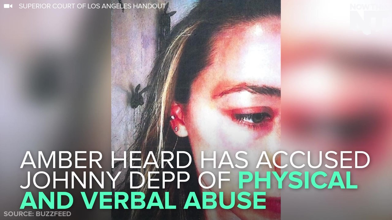 Amber Heard Alleges Abuse, Gets Restraining Order Against Johnny Depp