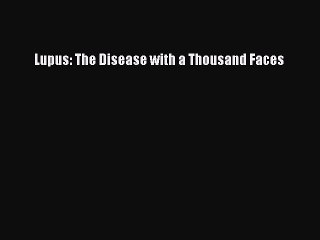 Download Lupus: The Disease with a Thousand Faces  Read Online