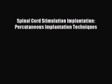 READ book Spinal Cord Stimulation Implantation: Percutaneous Implantation Techniques# Full