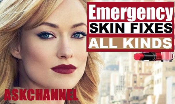 Emergency Skin Fixes! Blackheads, Dry Patches, Oiliness and Pimples! 2016