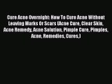 READ book Cure Acne Overnight: How To Cure Acne Without Leaving Marks Or Scars (Acne Cure