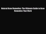READ book Natural Acne Remedies: The Ultimate Guide to Acne Remedies That Work# Full Free