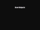 READ book Acne Vulgaris# Full Free