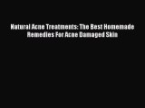 READ FREE FULL EBOOK DOWNLOAD Natural Acne Treatments: The Best Homemade Remedies For Acne