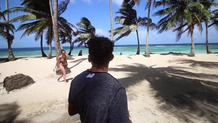 Her Worst Sunburn!!!