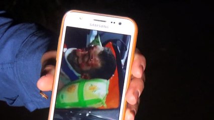 YOLDA KANLAR İÇİNDE BULUNDU, HAYATA TUTUNAMADI