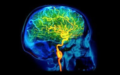 Intellux - Best And Effective Memory Boosting Formula