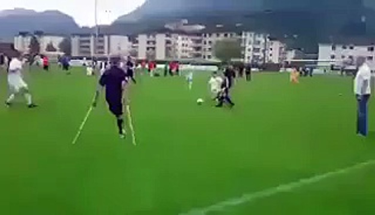 Jogador amputado de uma perna, jogador marca golo incrível