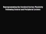 Read Reprogramming the Cerebral Cortex: Plasticity Following Central and Peripheral Lesions