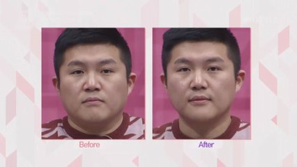 [선공개] 칫솔 하나로 조세호 소두 만들기!!