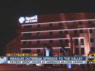 Mealses outbreak spreads to the Valley