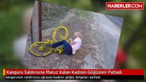 Kanguru Saldırısına Maruz Kalan Kadının Göğüsleri Patladı