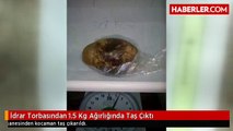 İdrar Torbasından 1.5 Kg Ağırlığında Taş Çıktı