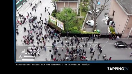 Loi Travail – Manifestant blessé par une grenade : De nouvelles images chocs ! (Vidéo)