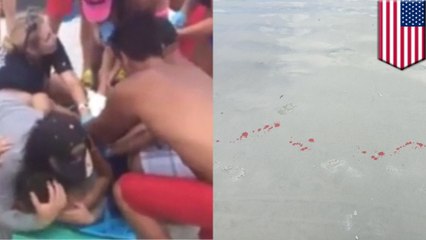 Shark attack! 13 year old Florida boy critically injured by shark