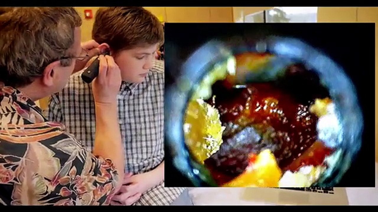 Le docteur envoie un liquide dans son oreille, puis ce qu'il en sort? OH MON DIEU!