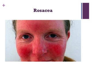 When to see your Dermatologist by Matthew David Cole MD