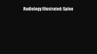 Read Radiology Illustrated: Spine Ebook Free