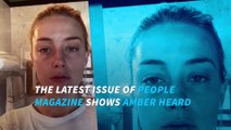 NEW PHOTOS: Amber Heard bruised face surface allegedly caused by Johnny Depp