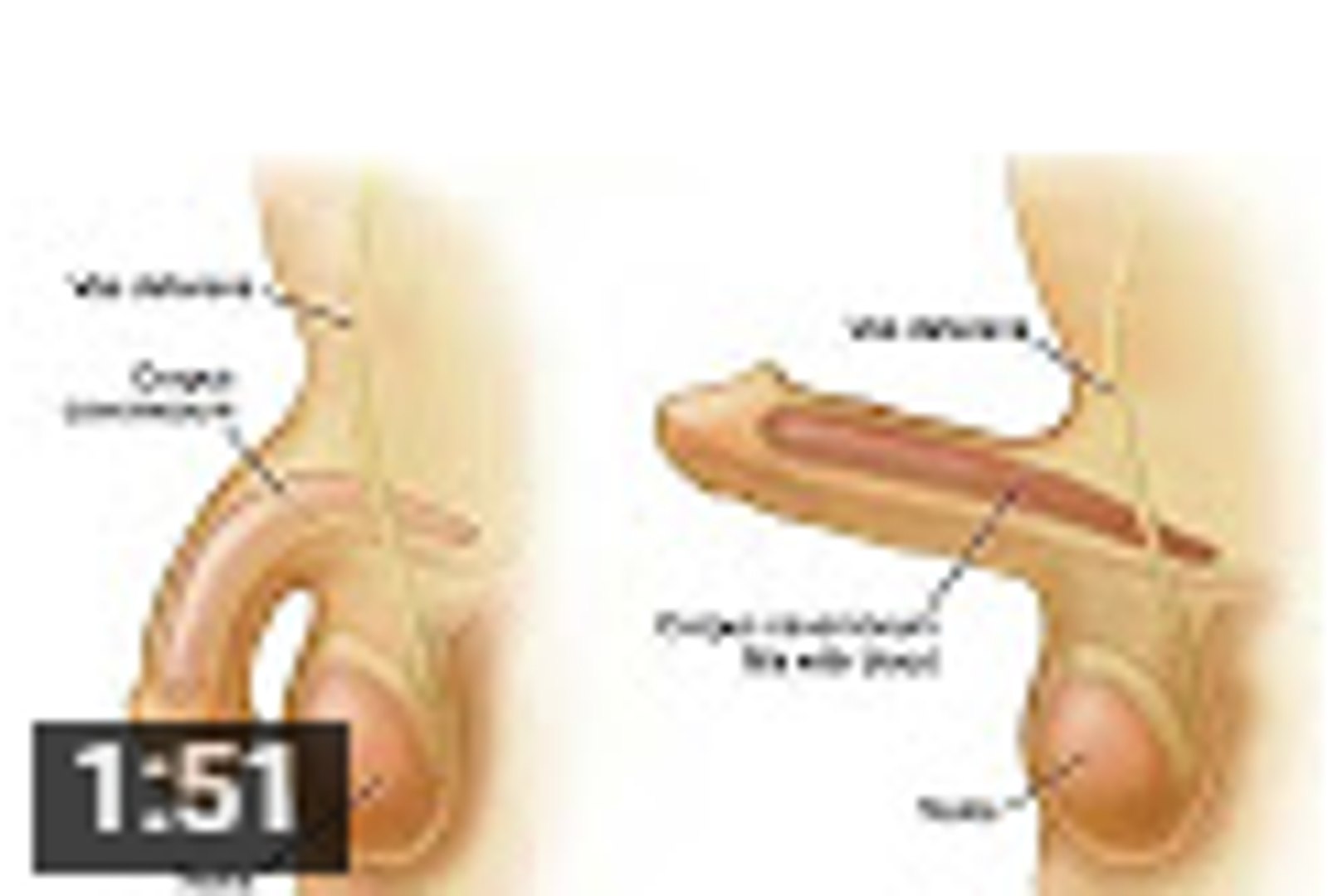 الثدي إدارة تاجر تمارين كيجل للرجال لتقوية الانتصاب Magicalindustry Aip Pt