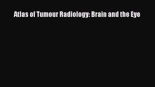 Read Atlas of Tumour Radiology: Brain and the Eye Ebook Online