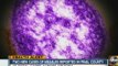 Two new cases of measles reported in Pinal County