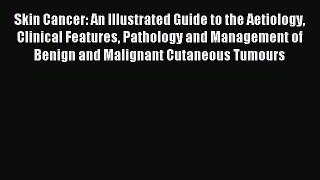 Read Skin Cancer: An Illustrated Guide to the Aetiology Clinical Features Pathology and Management