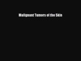 Read Malignant Tumors of the Skin Ebook Free