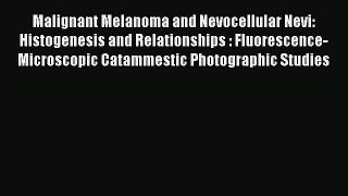 Read Malignant Melanoma and Nevocellular Nevi: Histogenesis and Relationships : Fluorescence-Microscopic