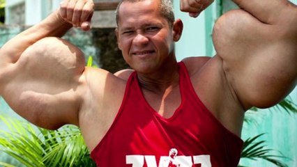 10 Bodybuilders That Went Too Far