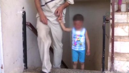 Savaşta Yüzü ve Vücudu Yanan Hamza İçin Umut Türkiye