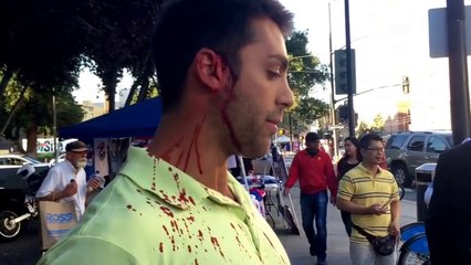 Trump supporter attacked in San Jose left bleeding