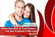 Herbal Remedies To Treat Sunburn And Skin Problems In Men And Women