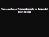 Read Transesophageal Echocardiography for Congenital Heart Disease Free Books