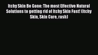 Read Itchy Skin Be Gone: The most Effective Natural Solutions to getting rid of Itchy Skin