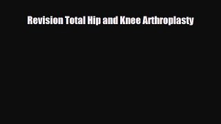 Download Revision Total Hip and Knee Arthroplasty Book Online