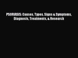Download PSORIASIS: Causes Types Signs & Symptoms  Diagnosis Treatments & Research PDF Online