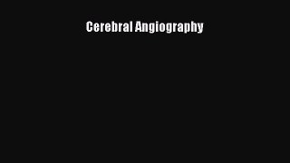 Read Cerebral Angiography Ebook Free