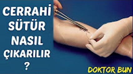 Cerrahi Sütür Nasıl Çıkarılır - Doktor Bun TV